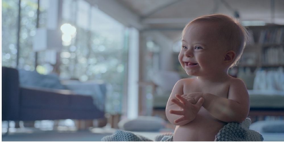 A imagem é uma reprodução da campanha da Johsons com a foto do bebê com Síndrome de Down